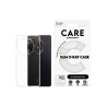 CARE by PanzerGlass X-Ray - Zadní kryt pro mobilní telefon - termoplastický polyuretan (TPU) - pruhledná - pro OnePlus Nord CE