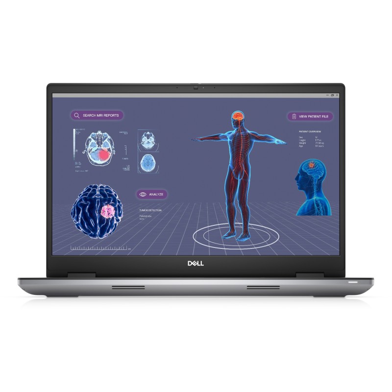 DELL Precision 7780/i7-13850HX/17" FHD/16GB/512GB SSD/RTX 2000 Ada/W11P/Gray/3Y NBD